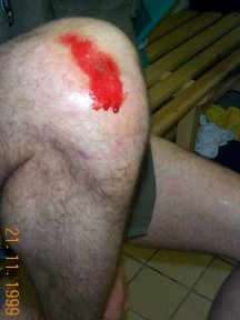 Kidner - always the hero playing on the ground - Ouch !